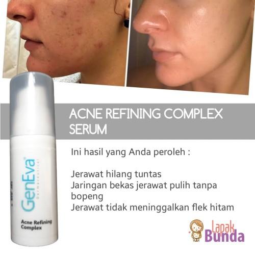 SERUM ACNE REFINING COMPLEX GENEVA 1 Serum Acne Refining Complex Geneva